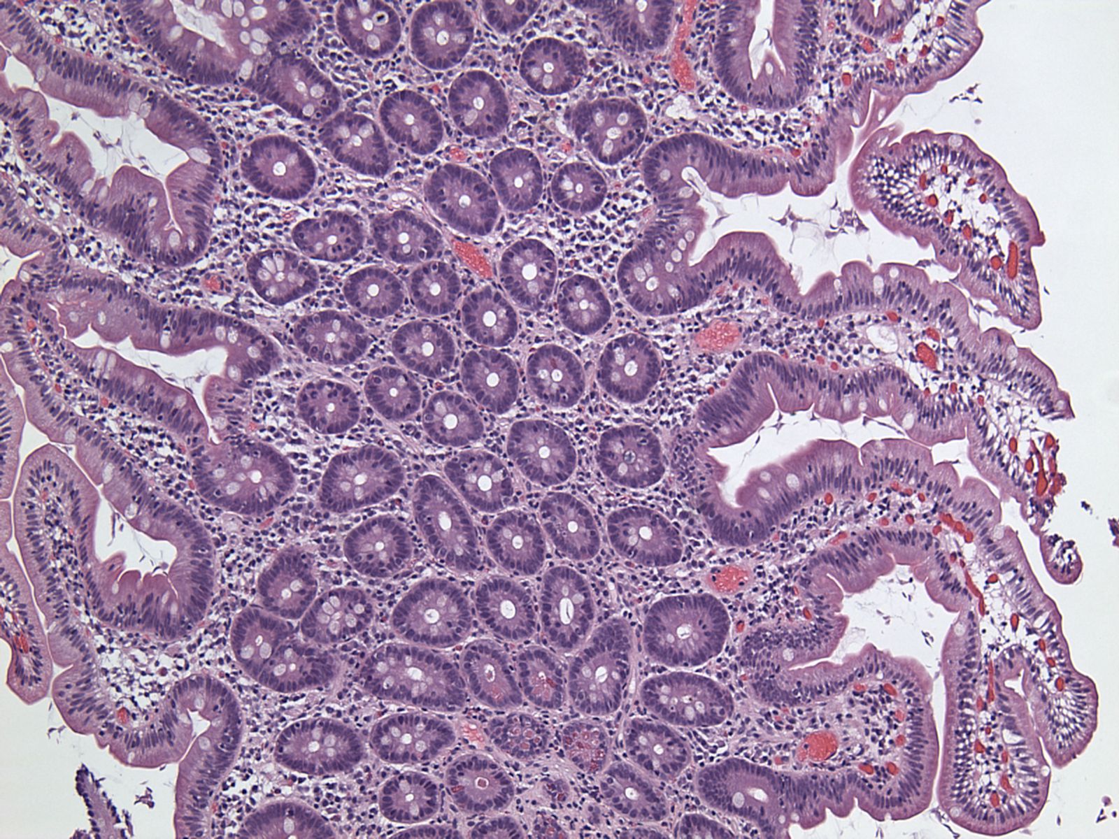 Path Image